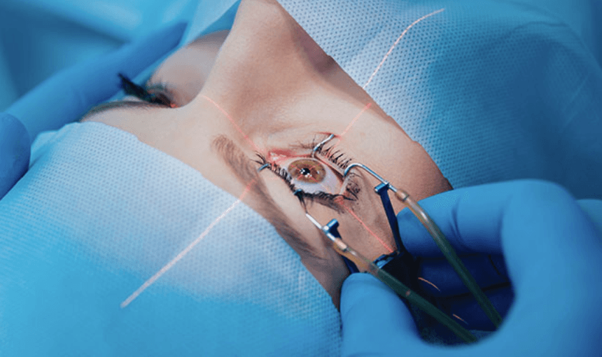 Advanced Cataract Surgery in Moradabad at Oracle Eye Hospital